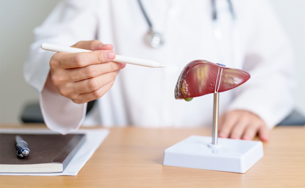 Steeds meer ‘dronken levers’ zonder alcohol: 1 op de 3 Nederlanders heeft leververvetting