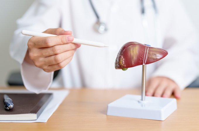 Steeds meer ‘dronken levers’ zonder alcohol: 1 op de 3 Nederlanders heeft leververvetting